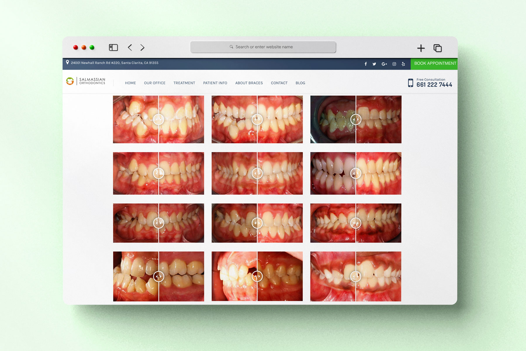 before after gallery example orthodontic website