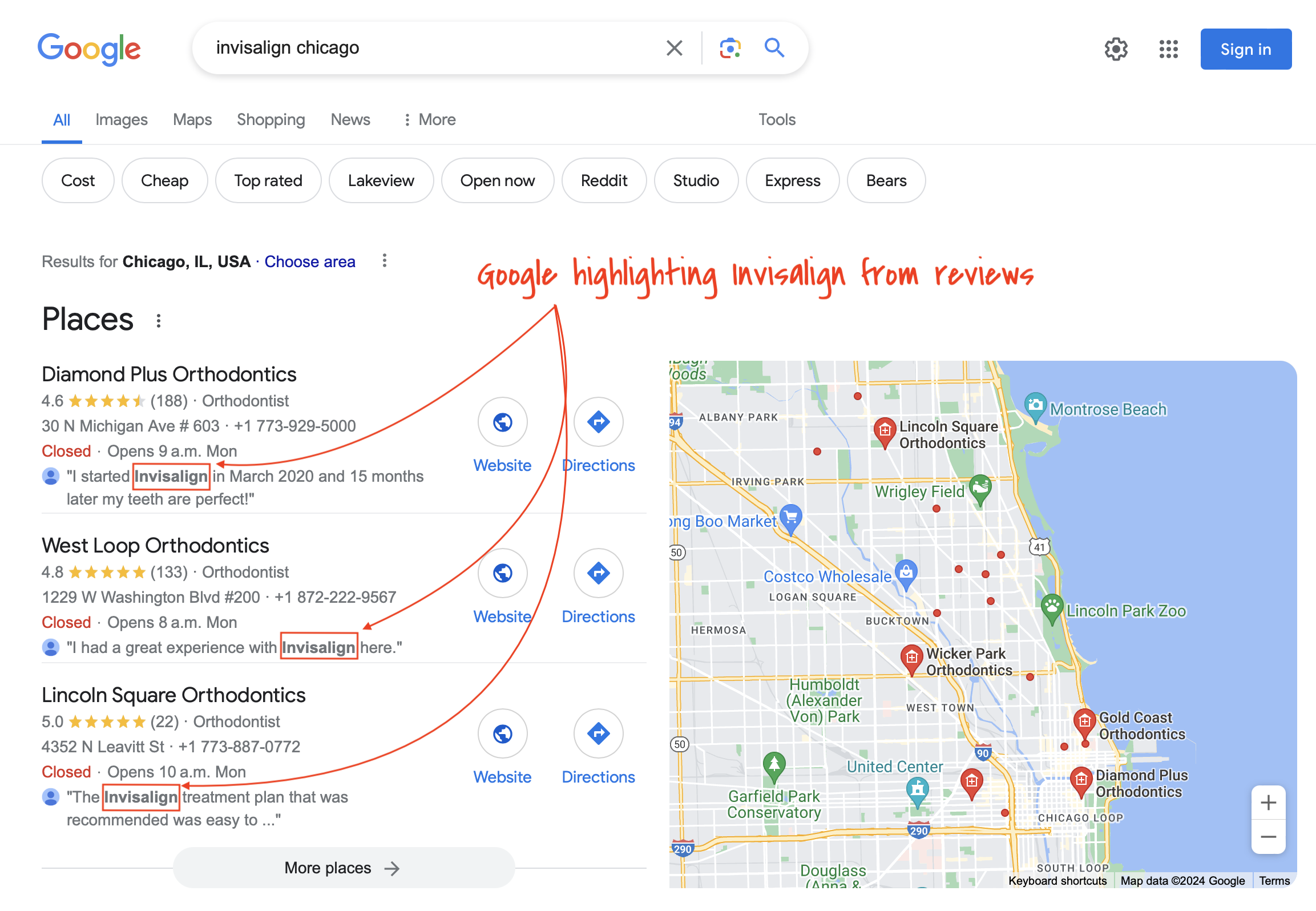 Google highlighting Invisalign from reviews